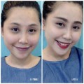 Làm đẹp - Hot girl Gào tự tin để mặt mộc nhiều mụn