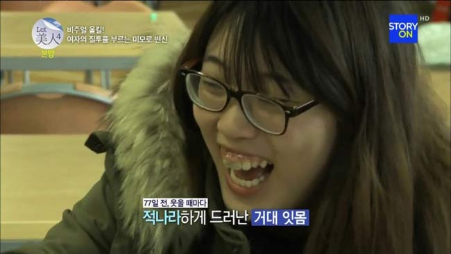 Nhưng ngay cả khi Yoona cố gắng sống vui vẻ thì nụ cười của cô lại là 'ác mộng' với nhiều người đối diện.
