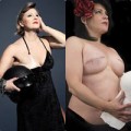 Làm đẹp - Hình ảnh vòng 1 của những phụ nữ ung thư vú