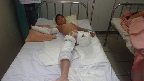 Thương tâm cậu bé mồ côi cha bị tai nạn phải cưa chân - 1