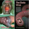 Tin tức - Dịch Ebola: Nguyên nhân, triệu chứng, cách phòng bệnh