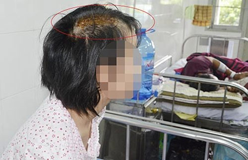 Bé 15 tuổi bị cha dượng chém nứt sọ - 1