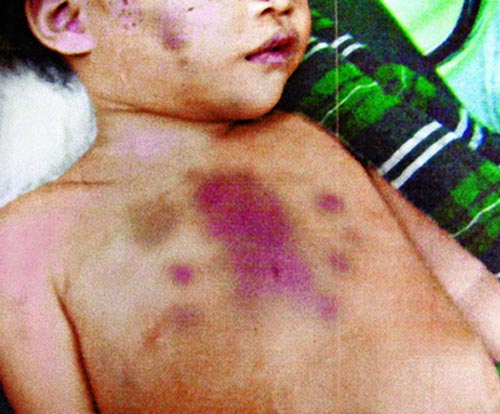 Không sinh được con trai, mẹ giết chết con gái 7 tháng tuổi - 1