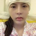 Làm đẹp - Vân Tokyo lại 'đổ' tiền phẫu thuật thái dương và môi cười