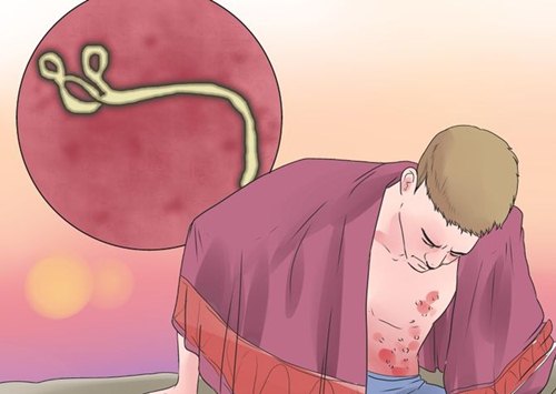 Những điều mẹ cần biết để ngăn ngừa Ebola - 1