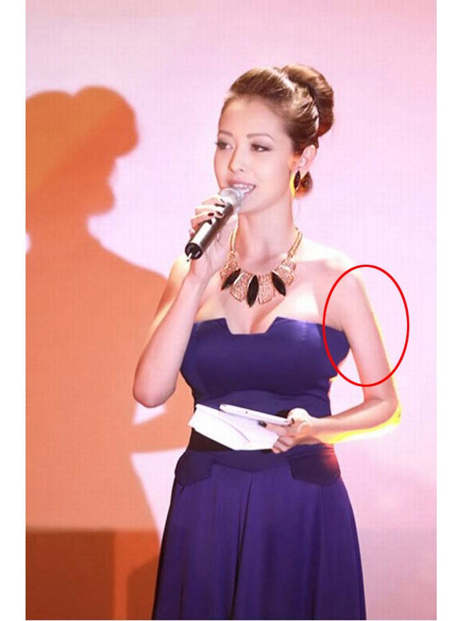 Cánh tay của Jennifer Phạm giống như bị teo cơ vì photoshop quá đà.
