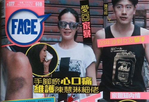 Á hậu Hongkong tố bạn trai hành hung - 1