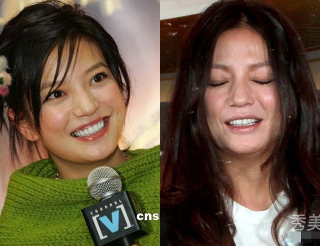 Triệu Vy đã từng gây sốc cho khán giả khi cô xuất hiện với gương mặt nhiều ngấn mỡ thừa.
