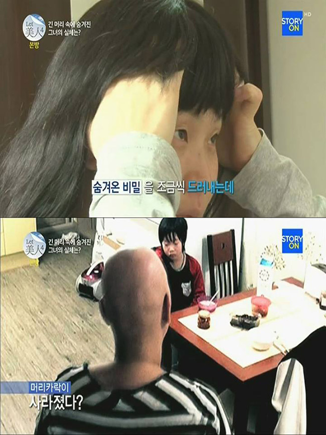Có thời gian Kim Hyun Soo đã tìm mua những bộ tóc giả đội vào để đỡ mặc cảm mỗi khi nhìn thấy chồng con và tự tin hơn lúc ra đường.
