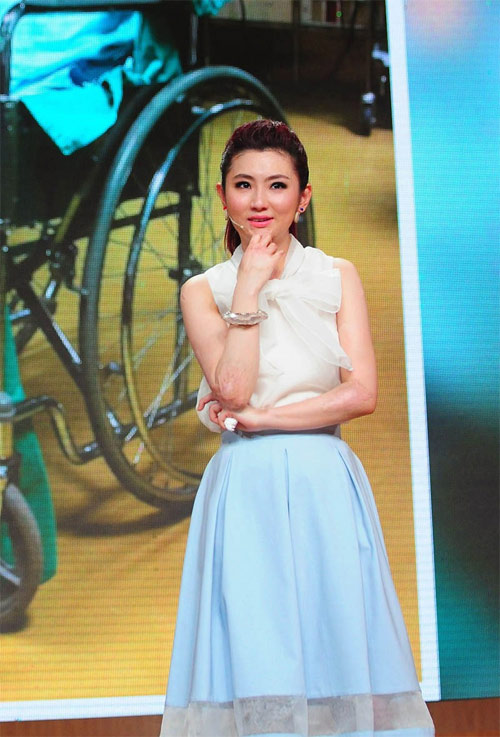 Mỹ nam CBiz biến dạng sau vụ nổ 4 năm trước - 7