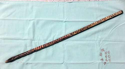 Thanh sắt xuyên thủng đầu vẫn sống sót thần kỳ - 5