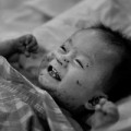Làm mẹ - Xót xa em bé da bóng nước bị người thân bỏ rơi