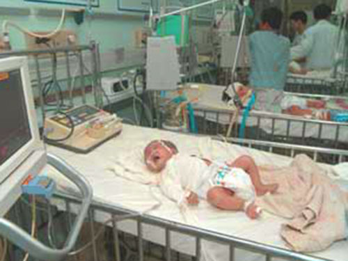 Bé sơ sinh bị uốn ván nguy kịch - 1