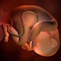 Thai nhi 35 tuần: Bé bằng quả dưa hấu