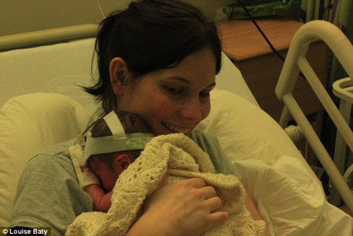 Cảm phục nghị lực giữ con của mẹ bị vỡ ối 16 tuần - 3