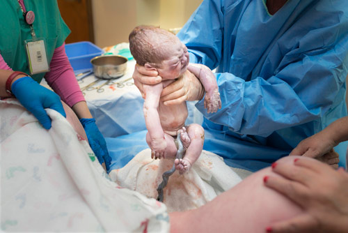 Hình ảnh tuyệt đẹp về dây rốn của bé khi mới chào đời - 5