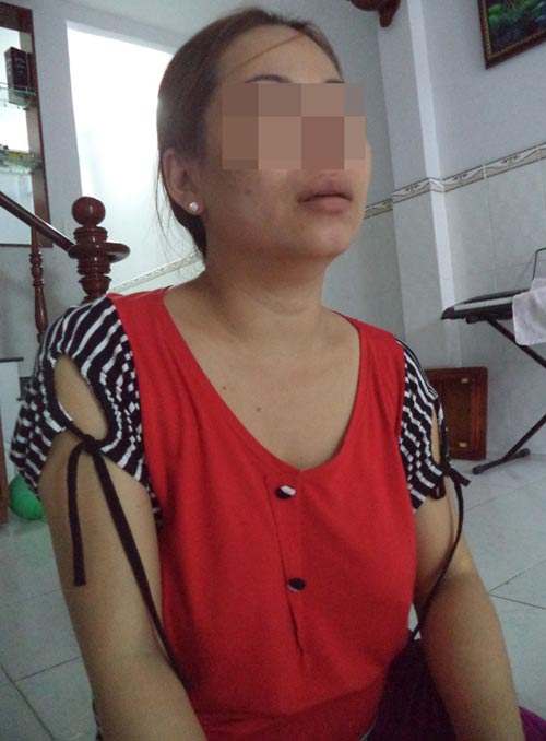 Chồng cuồng ghen dùng dao “trị tội” vợ - 2