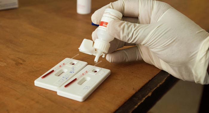 Tìm ra loại thuốc có thể “diệt tận gốc” HIV - 2