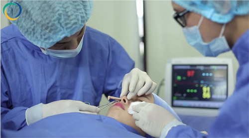 Các mẹ “mê mẩn” với bí quyết nâng mũi cao đẹp - 2