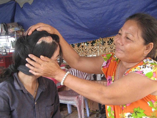 Gặp lại bé gái bị máy ép mía lột sạch da đầu - 3