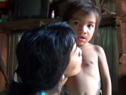 Bé gái suýt bị chôn sống vì bị mang danh quot;ma rừngquot; - 2
