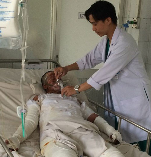 Vụ chồng châm lửa tự thiêu: Nỗi đau xót của người thân - 1