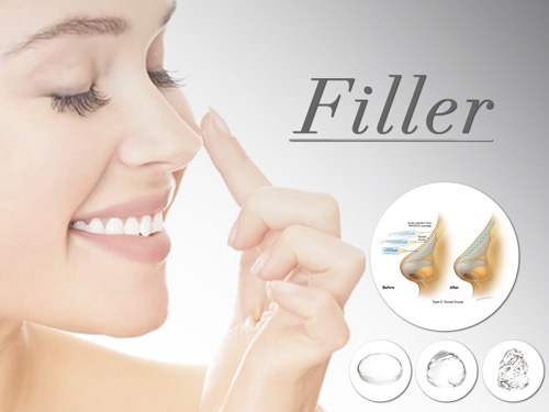 Kinh nghiệm chọn phương pháp nâng mũi phù hợp - 2