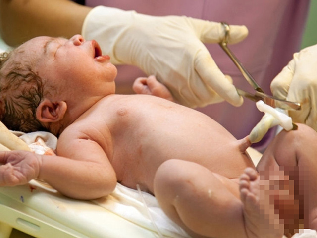 Chậm cắt dây rốn sau sinh: Lợi đủ đường!