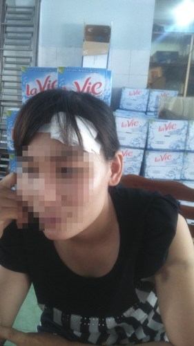 Lời kể kinh hoàng của người phụ nữ bị chồng hờ truy sát - 1