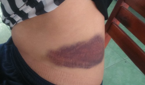 Lời kể kinh hoàng của người phụ nữ bị chồng hờ truy sát - 2