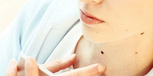 Các dấu hiệu nhận biết và những hiểm họa đáng sợ từ ung thư da - 3