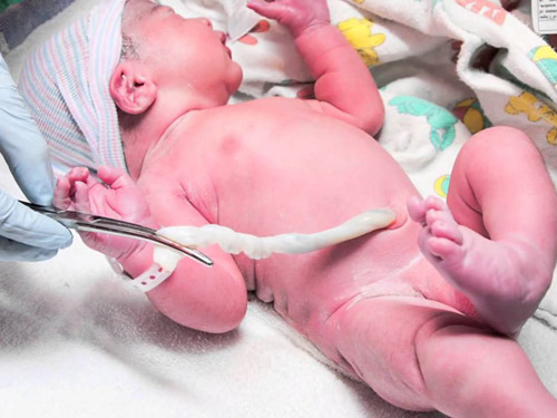 Dây rốn thai nhi – những bí ẩn mẹ chưa biết - 2