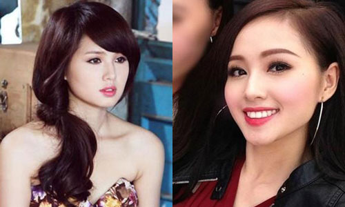 Những mỹ nhân Việt - Hoa #039;dính#039; nghi án độn cằm quá đà - 4