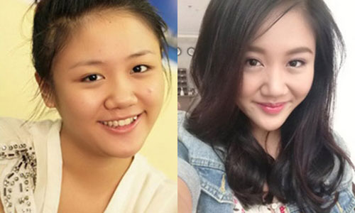 Những mỹ nhân Việt - Hoa #039;dính#039; nghi án độn cằm quá đà - 2