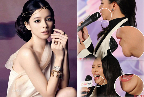 Những mỹ nhân Việt - Hoa #039;dính#039; nghi án độn cằm quá đà - 11