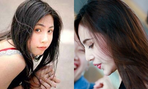 Những mỹ nhân Việt - Hoa #039;dính#039; nghi án độn cằm quá đà - 6