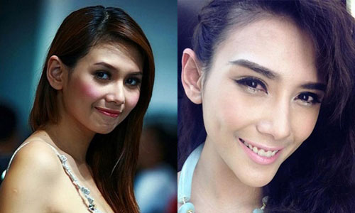 Những mỹ nhân Việt - Hoa #039;dính#039; nghi án độn cằm quá đà - 5