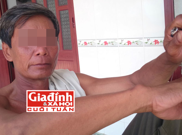 Gặp người từng chứng kiến mẹ bị sát hại trong ngày cưới - 1