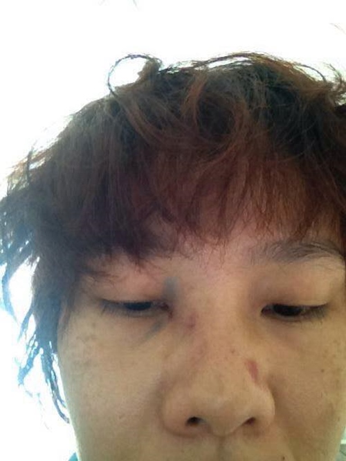 Dương Yến Ngọc tố bị chồng cũ đánh đập, hành hung - 4