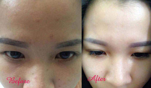 Cô gái cải thiện làn da trong 10 ngày bằng mật ong, sữa chua - 1