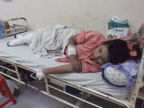 Giận chị gái, phóng hỏa khiến 4 người bị bỏng nặng - 2