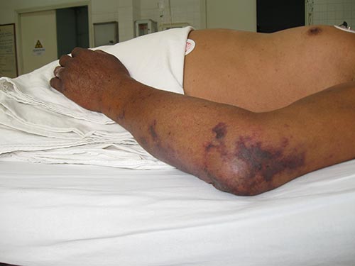 Đừng “đùa” với món tiết canh! - 1