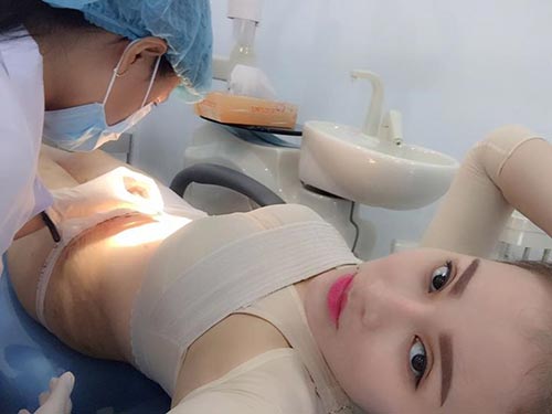 9x hai con kể chuyện đi cắt mỡ thừa ở bụng sau sinh - 7