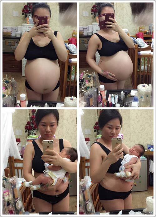9x hai con kể chuyện đi cắt mỡ thừa ở bụng sau sinh - 5