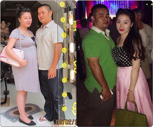 9x hai con kể chuyện đi cắt mỡ thừa ở bụng sau sinh - 4