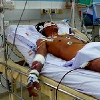 Bị nhiễm liên cầu lợn vì ăn tiết chưa nấu kỹ - 1
