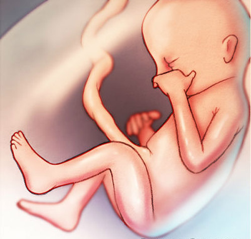 Cẩn trọng chứng giãn não thất ở thai nhi - 1