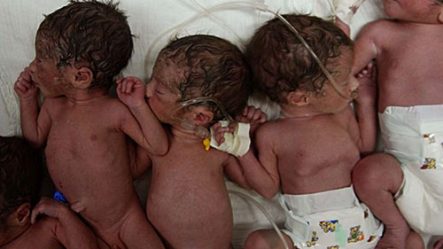 Ca sinh 7 hy hữu trên thế giới của bà mẹ 30 tuổi - 1