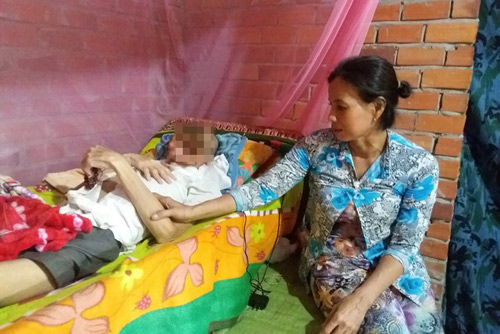 Bi kịch người đàn ông bị căn bệnh lạ “ăn” mất khuôn mặt - 1