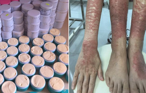 Ám ảnh kem trộn và giải pháp cho làn da trắng - 1